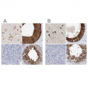 Anti-RCN2 antibody produced in rabbit 