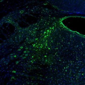 Anti-RCN2 antibody produced in rabbit 