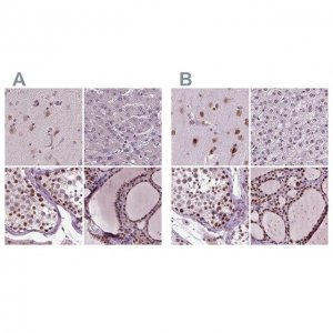 Anti-RCOR3 antibody produced in rabbit 