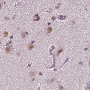 Anti-RCOR3 antibody produced in rabbit 
