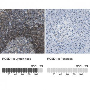 Anti-RCSD1 antibody produced in rabbit 