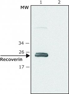 Anti-Recoverin (C-terminal) antibody produced in rabbit SAB4200309-200UL