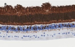Anti-Recoverin Antibody, clone 1J23, ZooMAb Rabbit Monoclonal 
