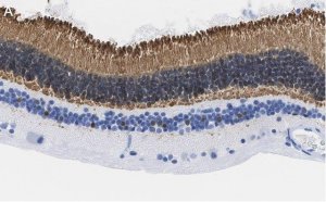 Anti-Recoverin Antibody, clone 1K10 ZooMAb Rabbit Monoclonal 