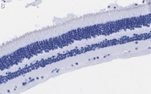 Anti-Recoverin Antibody, clone 1K10 ZooMAb Rabbit Monoclonal 