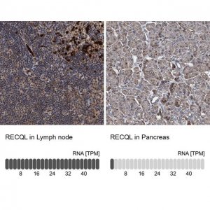 Anti-RECQL antibody produced in rabbit 