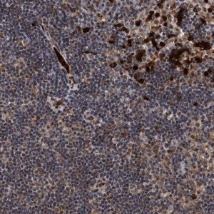 Anti-RECQL antibody produced in rabbit 