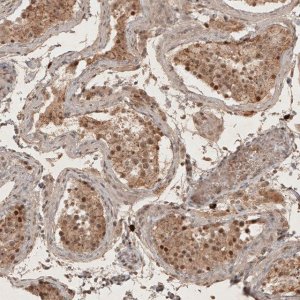 Anti-RECQL5 antibody produced in rabbit 
