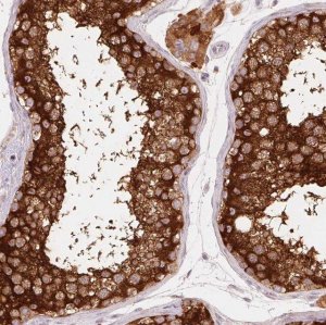 Anti-REEP6 antibody produced in rabbit 