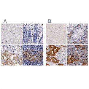 Anti-RENBP antibody produced in rabbit HPA000428-100UL