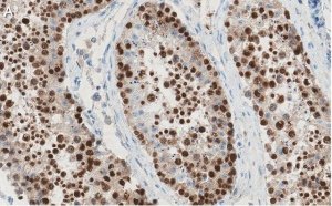 Anti-REST Antibody, clone 2E3 ZooMAb Rabbit Monoclonal 