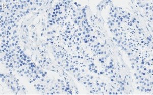 Anti-REST Antibody, clone 2E3 ZooMAb Rabbit Monoclonal 