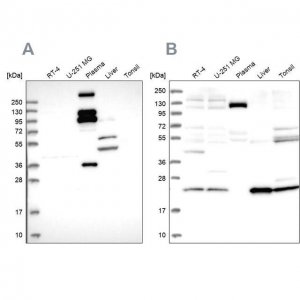 Anti-REXO1 antibody produced in rabbit 