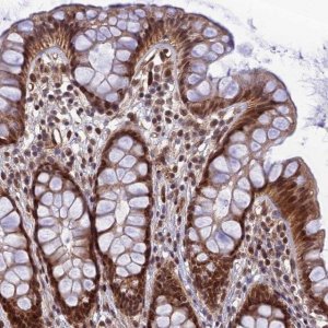 Anti-REXO1 antibody produced in rabbit 