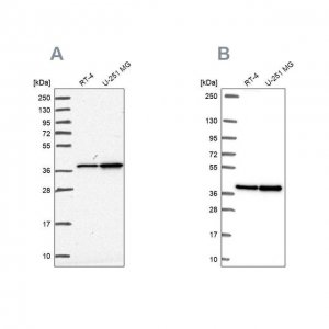 Anti-RFC4 antibody produced in rabbit 