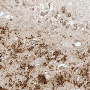 Anti-RFTN2 antibody produced in rabbit 