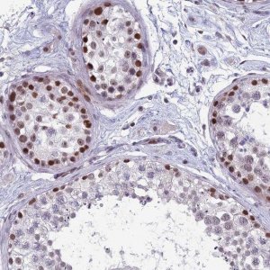Anti-RGS17 antibody produced in rabbit 