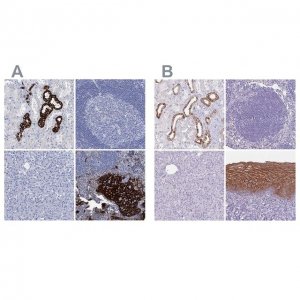 Anti-RHCG antibody produced in rabbit 