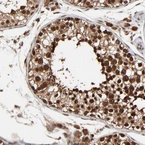 Anti-RHOJ antibody produced in rabbit 
