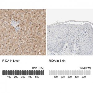 Anti-RIDA antibody produced in rabbit HPA023489-100UL