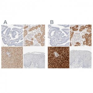 Anti-RIDA antibody produced in rabbit HPA023489-100UL