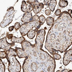 Anti-RILPL2 antibody produced in rabbit 