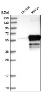 Anti-RING1 antibody produced in rabbit HPA008701-100UL