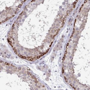 Anti-RIOK1 antibody produced in rabbit 