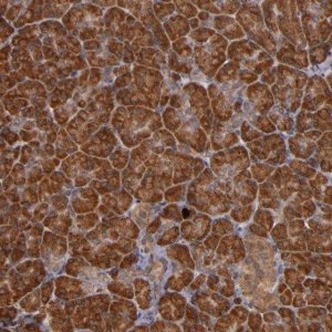 Anti-RIOK3 antibody produced in rabbit 