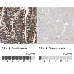 Anti-RIPK1 antibody produced in rabbit 