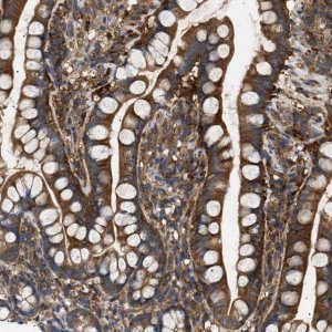 Anti-RIPK1 antibody produced in rabbit 
