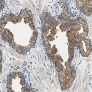 Anti-RIPK2 antibody produced in rabbit 