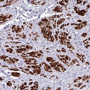 Anti-RIPPLY1 antibody produced in rabbit 