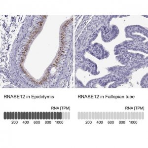 Anti-RNASE12 