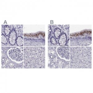 Anti-RNASE12 