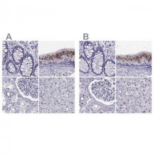 Anti-RNASE12 antibody produced in rabbit 