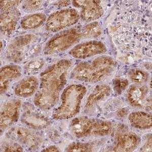 Anti-RNASE7 antibody produced in rabbit 