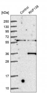 Anti-RNF138 antibody produced in rabbit 