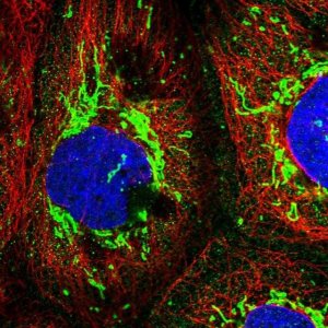 Anti-RNF138 antibody produced in rabbit 
