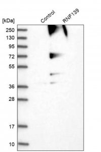 Anti-RNF139 antibody produced in rabbit 