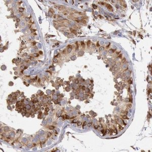 Anti-RNF139 antibody produced in rabbit 