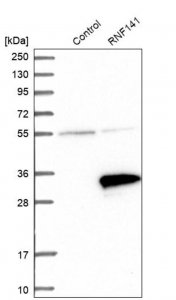 Anti-RNF141 antibody produced in rabbit 