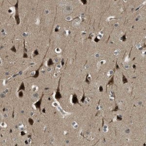 Anti-RNF141 antibody produced in rabbit 
