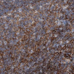 Anti-RNF182 antibody produced in rabbit HPA012309-100UL