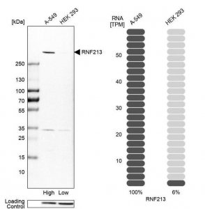 Anti-RNF213 antibody produced in rabbit 