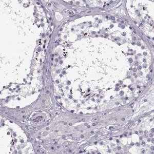 Anti-RNF32 antibody produced in rabbit 