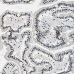 Anti-RNF43 antibody produced in rabbit 