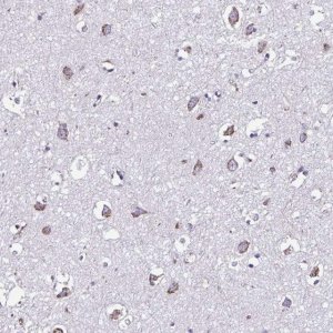 Anti-RNFT2 antibody produced in rabbit HPA064161-100UL