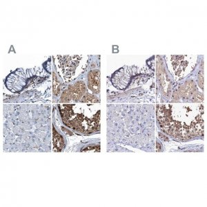 Anti-RNH1 antibody produced in rabbit HPA039223-100UL