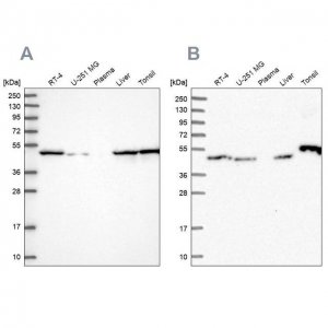 Anti-RNH1 antibody produced in rabbit HPA039223-100UL